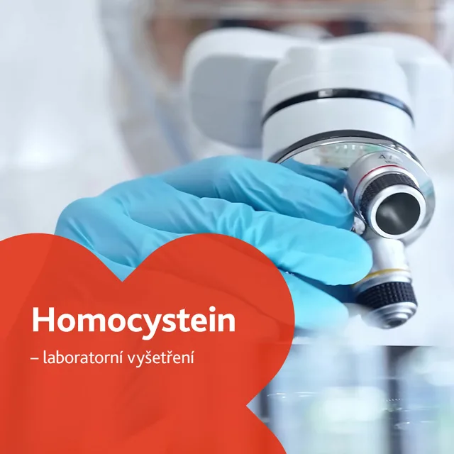 Homocystein - laboratorní vyšetření
