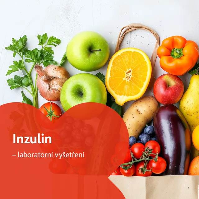 Inzulin - laboratorní vyšetření