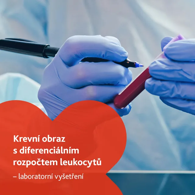 Krevní obraz s diferenciálním rozpočtem leukocytů - laboratorní vyšetření
