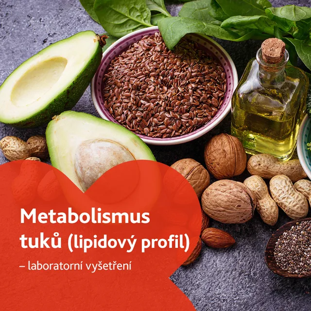 Metabolismus tuků (lipidový profil) - laboratorní vyšetření