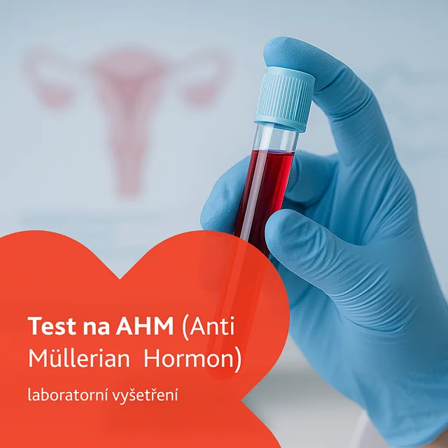 Test na AHM (Anti Müllerian Hormon) laboratorní vyšetření