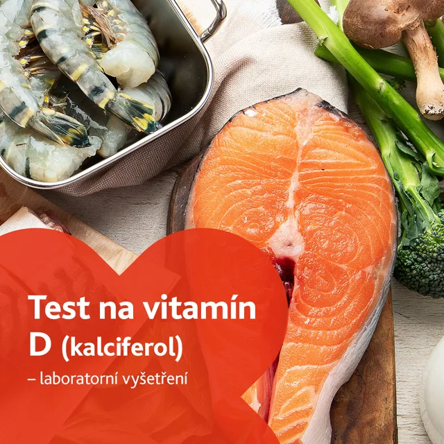 Test na vitamín D (kalciferol) - laboratorní vyšetření