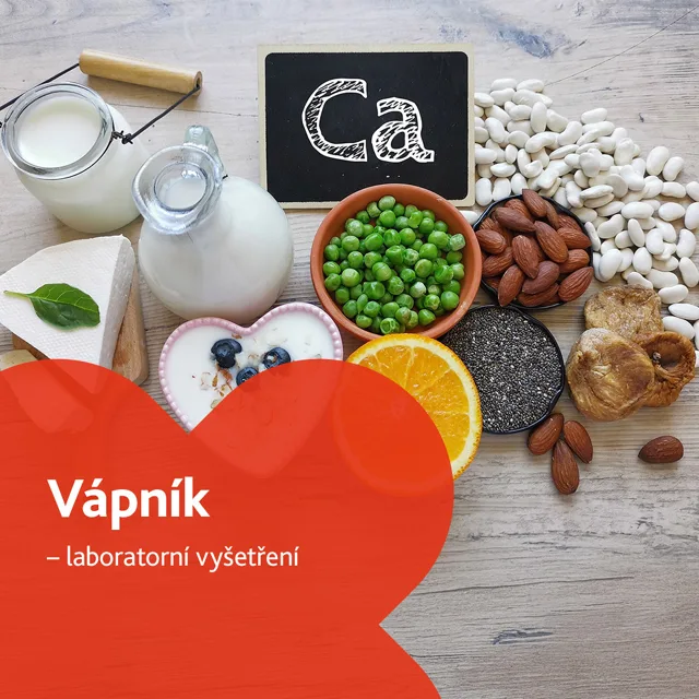 Vápník - laboratorní vyšetření